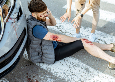 Injured male pedestrian sitting on the ground next to a car after being hit.