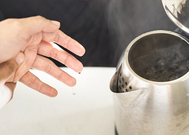 Hand near a steaming kettle, illustrating an injury from a faulty product. Title: Help With Injuries From A Defective Product.